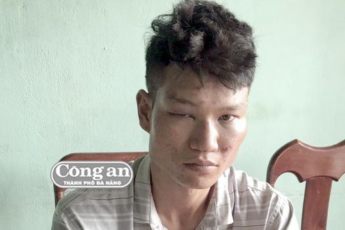 'Cẩu tặc' sa lưới