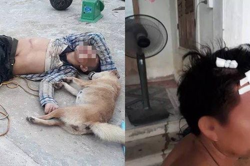 Tri hô trộm chó, chủ nhà bị cẩu tặc lao vào đánh trọng thương
