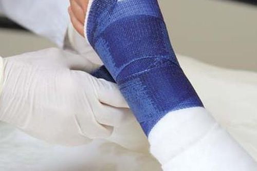 Kỳ lạ vít biến thành xương, từ nay người bị gãy xương không còn lo phải mổ lần nữa