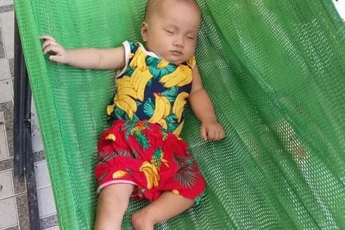 Xót thương bé song sinh qua nhiều lần mổ tim mới giữ được tính mạng