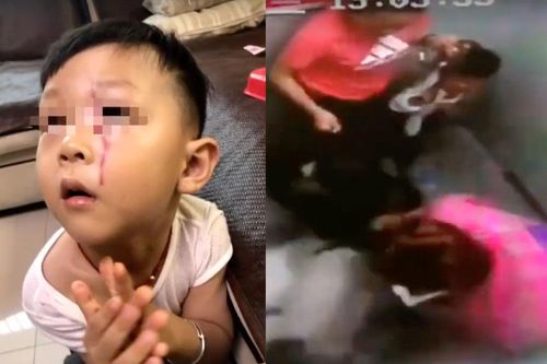 Bà hoảng hồn chứng kiến cháu trai bị chó tấn công trong thang máy chung cư