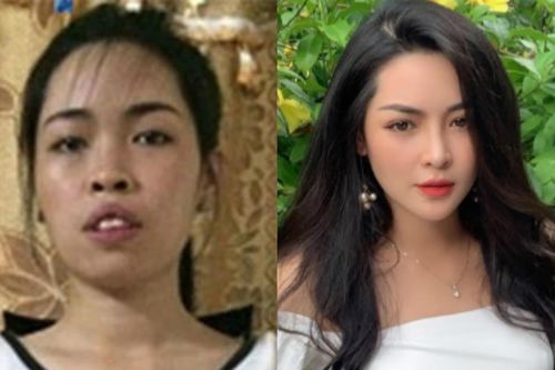 Cô gái từng không thể xin việc, phải nhờ tới thẩm mỹ giờ ra sao