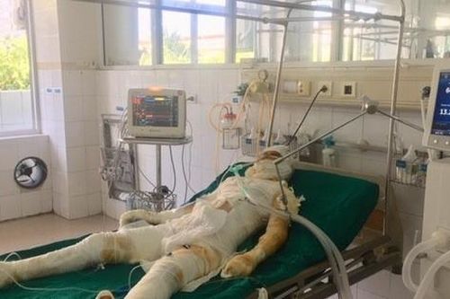 Từ vụ chém rồi thiêu sống cả nhà người tình ở Sơn La: Làm gì để chế ngự được cơn ghen?