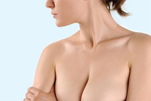Ngực phình to gấp đôi sau tiêm filler