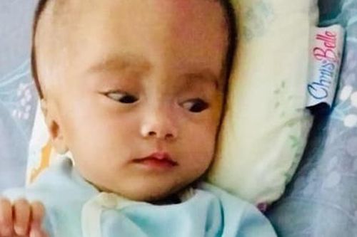 Triệu Hoài An - bé gái chiến đấu với căn bệnh não nước bằng tất cả sự lạc quan đã ra đi mãi mãi
