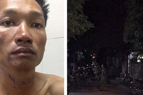 Lên cơn ghen, phóng hỏa đốt nhà rồi dìm chết vợ dưới bể nước