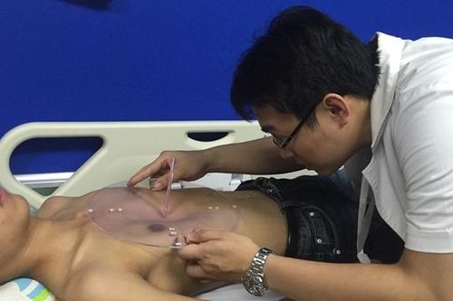 Điều trị bệnh lõm ngực bằng phương pháp mới