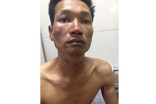 Đốt nhà, sát hại vợ vì bị thách thức