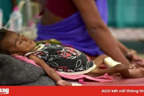 Chế độ ăn 'kỳ diệu' cho hàng triệu trẻ em suy dinh dưỡng