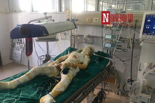 Tin mới về sức khỏe nạn nhân trong nghi án người tình phóng hỏa giết người ở Sơn La