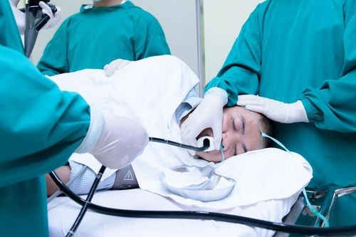 Có nên gây mê khi nội soi dạ dày?