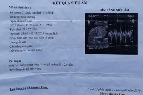 Bé gái 14 tuổi ở Bình Định bị xâm hại, mang thai 6 tháng