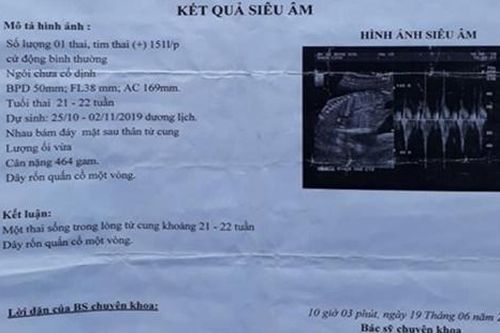 Bé gái 14 tuổi bị xâm hại đến mang thai