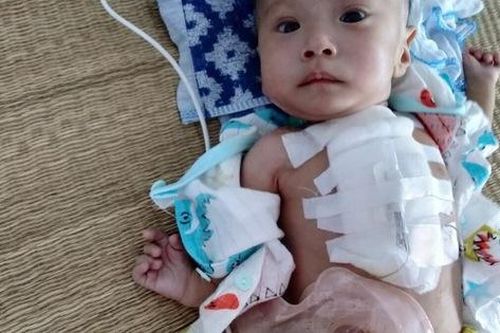 Sự sống mong manh của bé trai 4 tháng tuổi gồng mình chống chọi đủ thứ bệnh