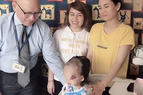 Hành trình tìm lại hy vọng cho cô bé có gương mặt dị dạng