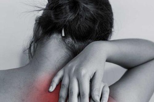 Nếu hay bị đau mỏi vùng vai, gáy, cổ bạn cần phải nhớ những điều này để tránh bị tái phát