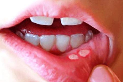 Những dấu hiệu 'tố cáo' cơ thể đang thiếu vitamin trầm trọng