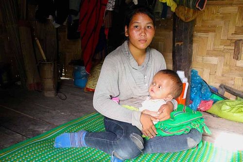 Mẹ nghèo đơn thân nuôi con nhỏ bị não úng thủy