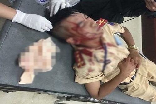 Lý lịch bất hảo của đối tượng cầm đá đánh Đại úy CSGT