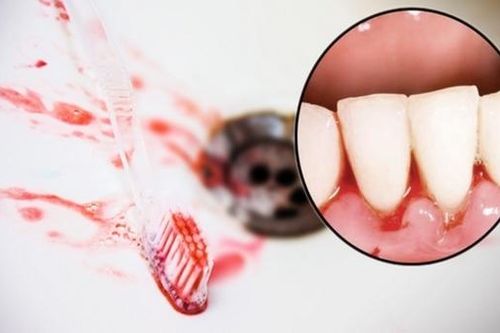 4 tín hiệu này xuất hiện trên mặt, báo hiệu ung thư gan cận kề