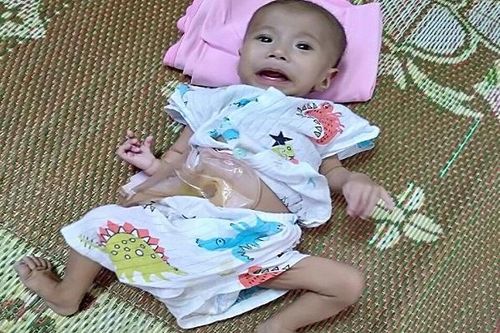 Tiếng khóc xé lòng của bé trai 4 tháng tuổi mắc nhiều căn bệnh bẩm sinh