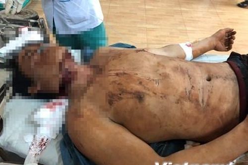 Bắt nghi can sát hại đồng nghiệp vì mâu thuẫn trong lúc nhậu