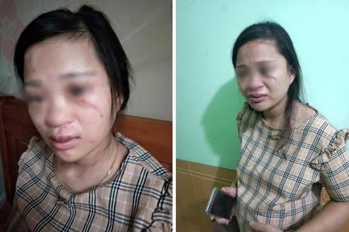 Thai phụ 8 tháng bị chồng đánh vì mua giày online phải nằm một chỗ vì động thai