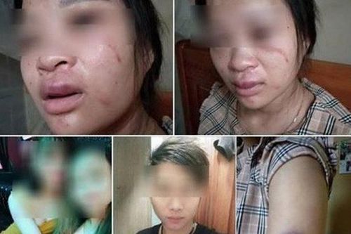 Chỉ vì mua đôi giày, thai phụ bị chồng đánh động thai