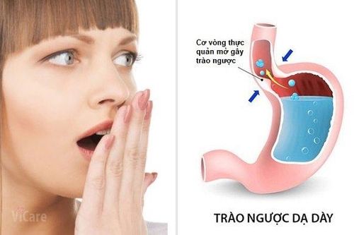 Dấu hiệu trào ngược dạ dày bạn nên biết