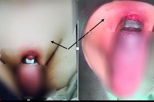 Nghịch dại suýt rụng 'của quý'
