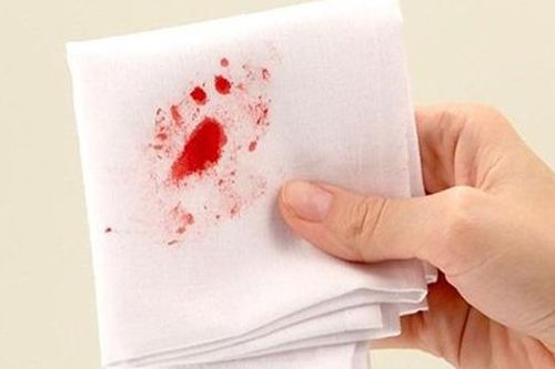 Dấu hiệu khiến nhiều người nhầm lẫn ung thư ruột với bệnh trĩ