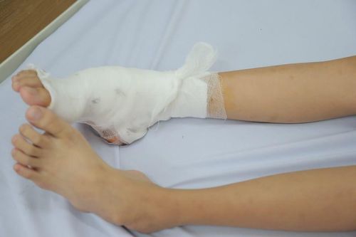 Bệnh lý hiếm gặp khiến bé gái 14 tuổi phải phẫu thuật gấp