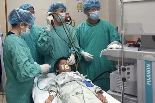 Xương cá nằm một tháng trong phế quản của cậu bé 10 tuổi