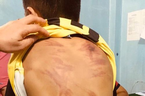 Đề nghị khởi tố cư sĩ đánh bé trai 11 tuổi ở Bình Thuận