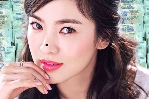 Tiết lộ 4 nốt ruồi phú quý 'ăn lộc'' quanh năm