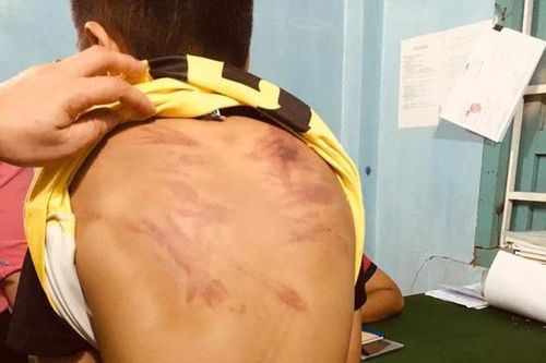 Bé trai 11 tuổi bị bạo hành ám ảnh mỗi khi đi ngang chùa