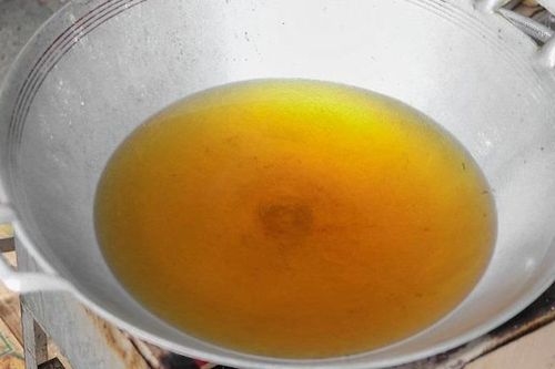 Bé 2 tuổi ngã vào chảo dầu, mẹ thiếu hiểu biết làm con bị lột da