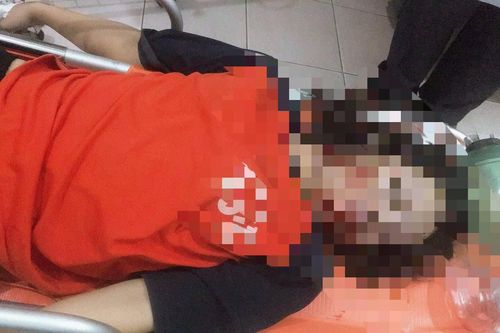 Vướng vào dây điện giữa đường, thiếu nữ 17 tuổi tử vong