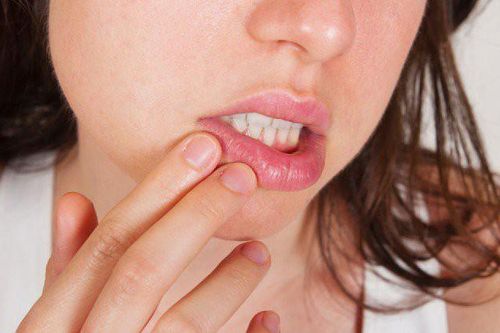 Nhiều trẻ dưới 15 tuổi biến chứng nặng vì bệnh lây qua đường tình dục