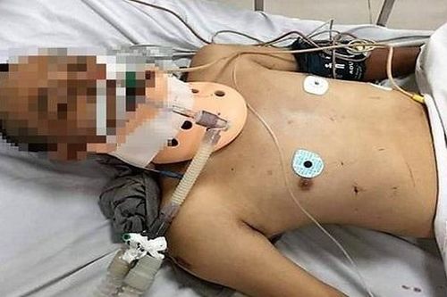 Truy tìm nhân thân của người đàn ông bị tai nạn tử vong khi đi bộ xuyên Việt