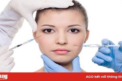 Cẩn trọng khi làm đẹp bằng filler