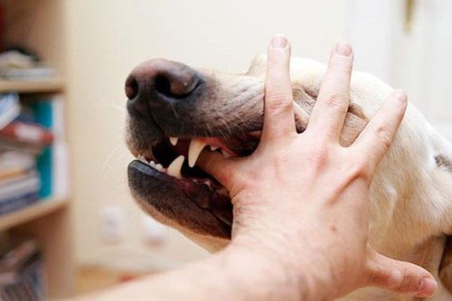 Người phụ nữ phải cắt cụt tứ chi vì thú cưng liếm vào vết thương
