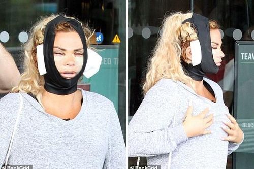 Hãi hùng gương mặt sưng phồng, biến dạng vì 'dao kéo' của Katie Price