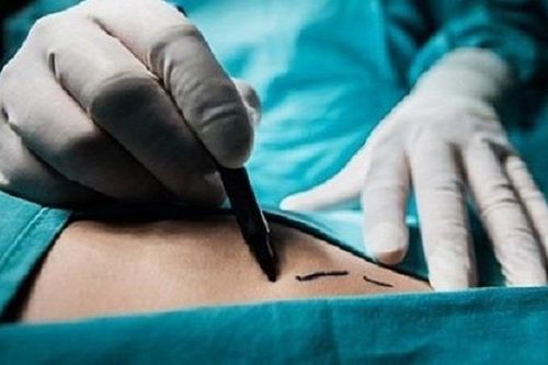 'Cò' môi giới bán thận giá 450 triệu đồng