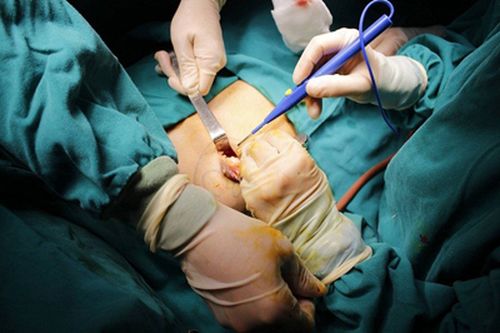 Cứu sống bệnh nhân bị vỡ tim, gãy hàng loạt xương sườn