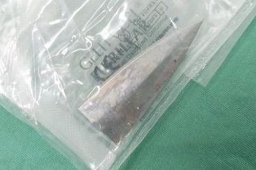 Bệnh nhân bị dao đâm xuyên tủy được cứu sống