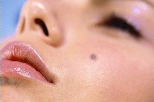 Đây là những quan niệm sai lầm về ung thư da nhiều người cần chú ý