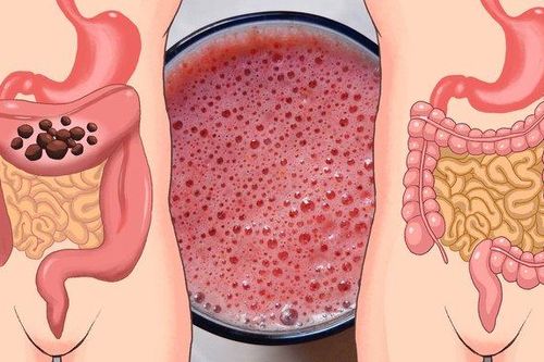 Những phương pháp từ tự nhiên giúp đường ruột của bạn luôn khỏe mạnh