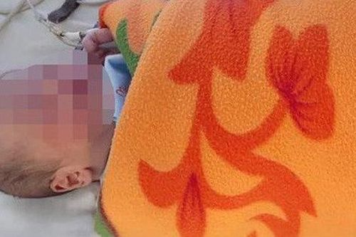 Nghệ An: Trẻ sơ sinh chưa cắt rốn bị bỏ rơi bên đường