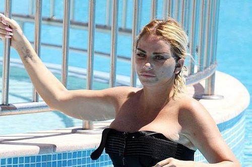 Katie Price xuất hiện với gương mặt biến dạng vì phẫu thuật thẩm mỹ